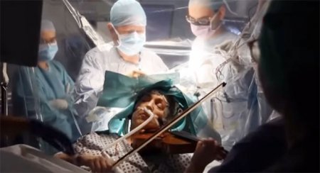 Xəstə beyin əməliyyatı zamanı skripka çaldı - Video