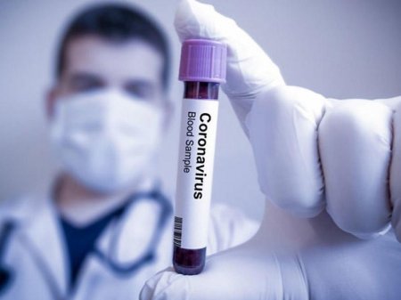 Koronavirusa qarşı virus yaradıldı