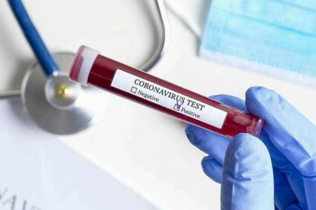Evdə müalicə olunan koronavirus xəstələri üçün QAYDALAR açıqlanıb